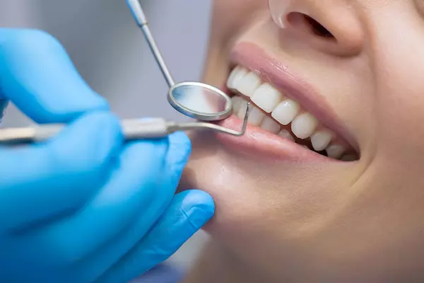 Tooth Bonding & White Fillings Larchmont NY | Eric Spellman, DMD | Larchmont Dentist